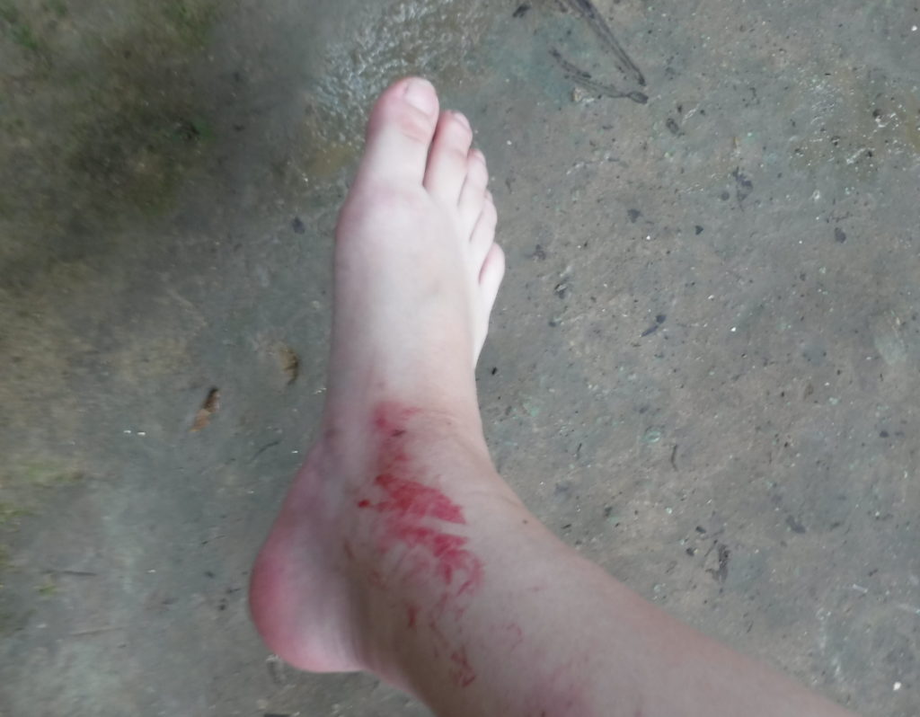 「クアンシーの滝」で足が真っ赤になっててビックリ